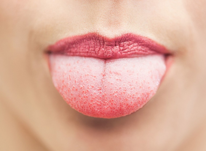 身体寒湿热应该怎样调理,体质寒湿的人怎么调理身体