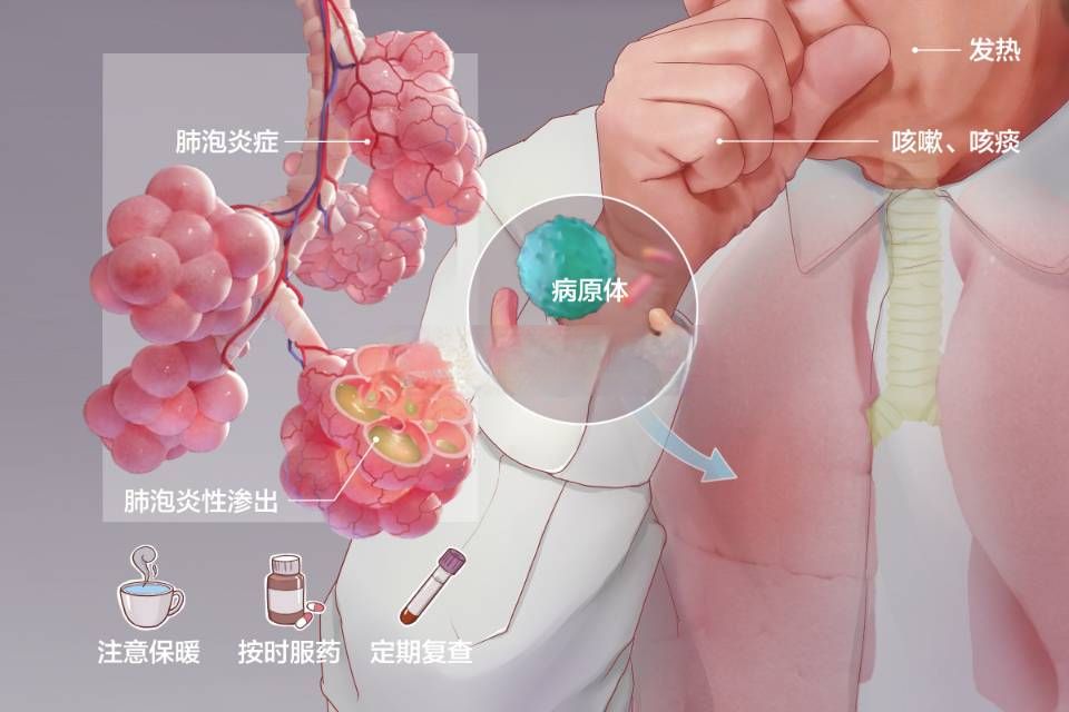 猫毛吸入肺里的危害,猫毛呼吸到肺里有害吗