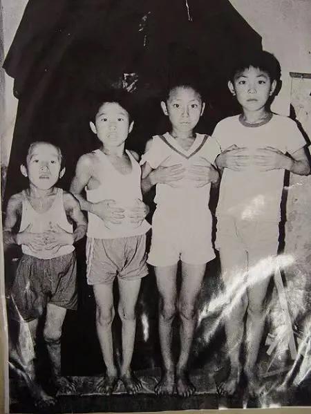 大骨节病科普视频,关于膝盖痛你了解多少