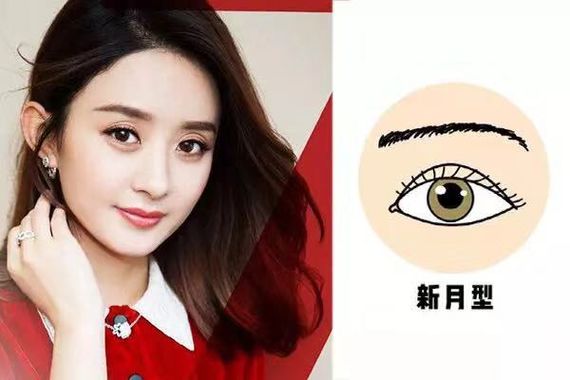 割双眼皮怎么变成内双了,割的双眼皮变成三角眼