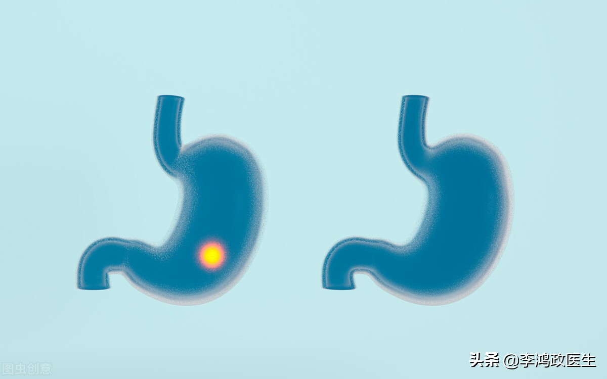 拉肚子便血了是癌症吗,长期腹泻便血是不是癌症晚期