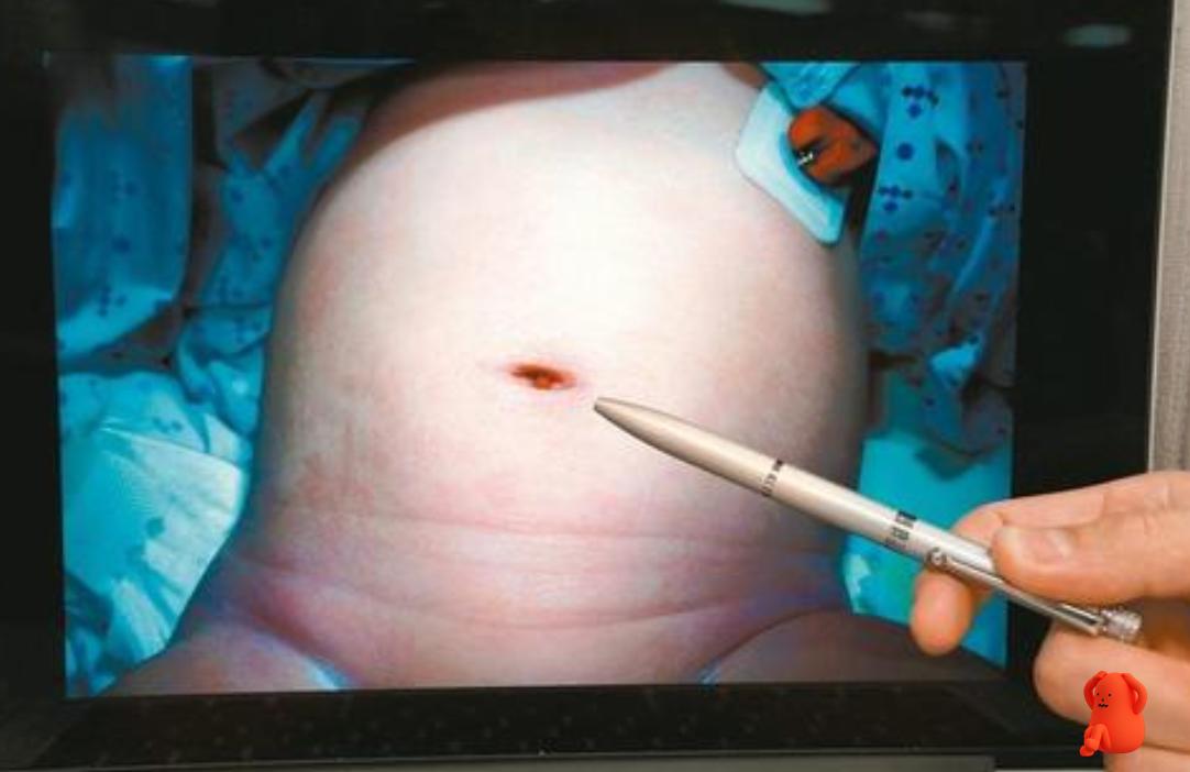 宝宝好奇扣屁股怎么办,宝宝好奇地抠肚脐