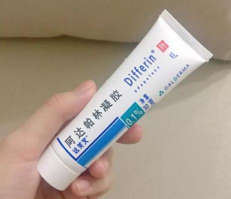 下巴反复长痘闭口粉刺用什么药膏,下巴粉刺痘痘反反复复怎么调理