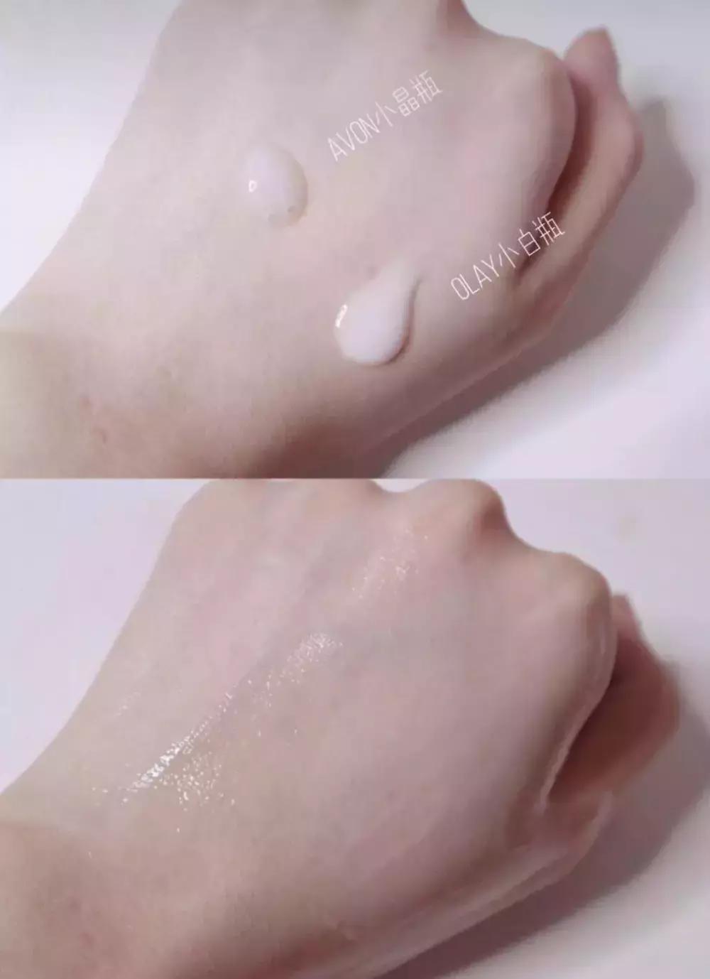 欧阳娜娜擦的药膏,欧阳娜娜擦什么药膏