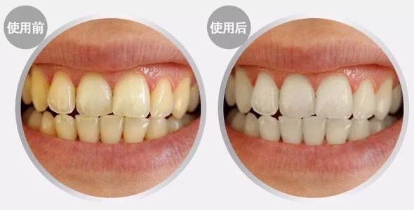 王子文沉浸式护肤分享,王子文美眼秘诀