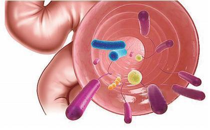 肠易激综合征与肠道菌群紊乱,肠道感染引起肠易激综合征吃啥药