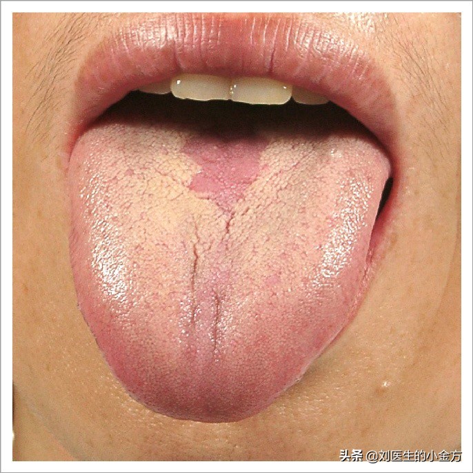 舌象图解大全中医舌诊,最全中医舌诊图谱来了