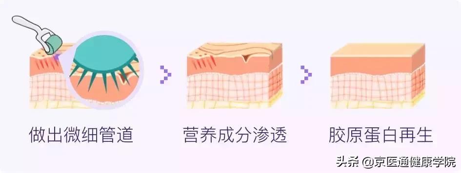 胶原蛋白真的有必要买吗,新手一定要知道的胶原蛋白骗局