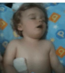 儿童反射性咳嗽,宝宝的咳嗽声像是要吐一样