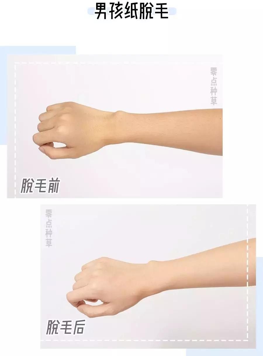 土方脱毛最有效的方法,简单又不用花钱的脱毛方法