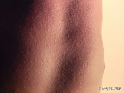 为什么让你家小孩远离嗓子发炎化脓的孩子？咽喉痛要吃抗生素吗？