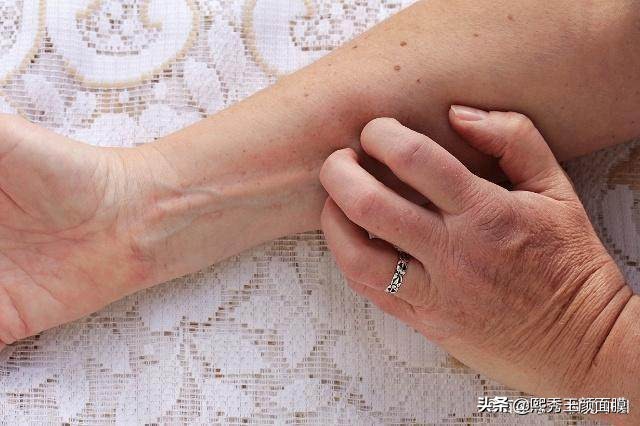 春季嘴巴一圈皮肤干燥起皮怎么办,春季皮肤干燥是什么原因