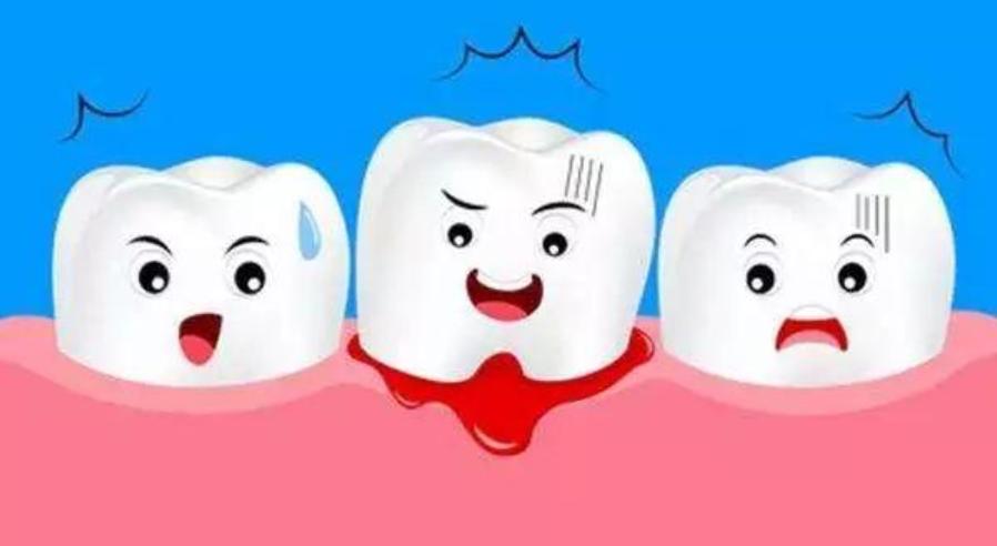 牙龈出血是怎么回事怎样治疗好,牙龈出血是什么原因怎么治疗最快