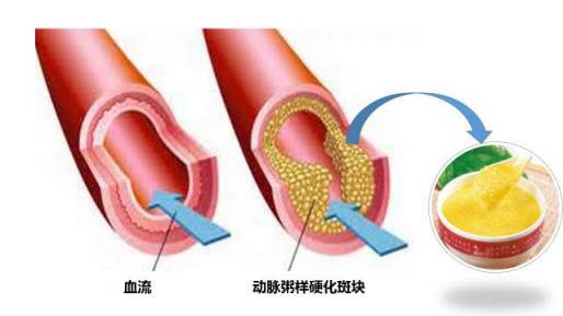 “小弟”勃起障碍是致命疾病的预警！
