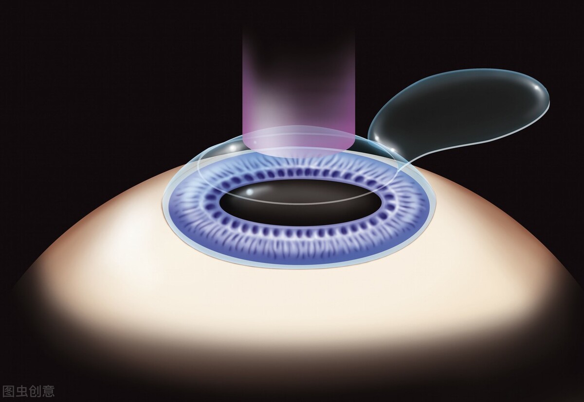 近视手术做不好医院会负责吗,近视手术那么好为什么医生不做