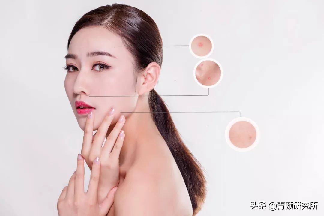 修复角质层薄红血丝敏感肌软膜,修复角质层薄红血丝敏感肌妙招