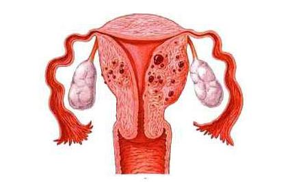 月经量超过80ml就不正常了吗,每次月经量少都是褐色的