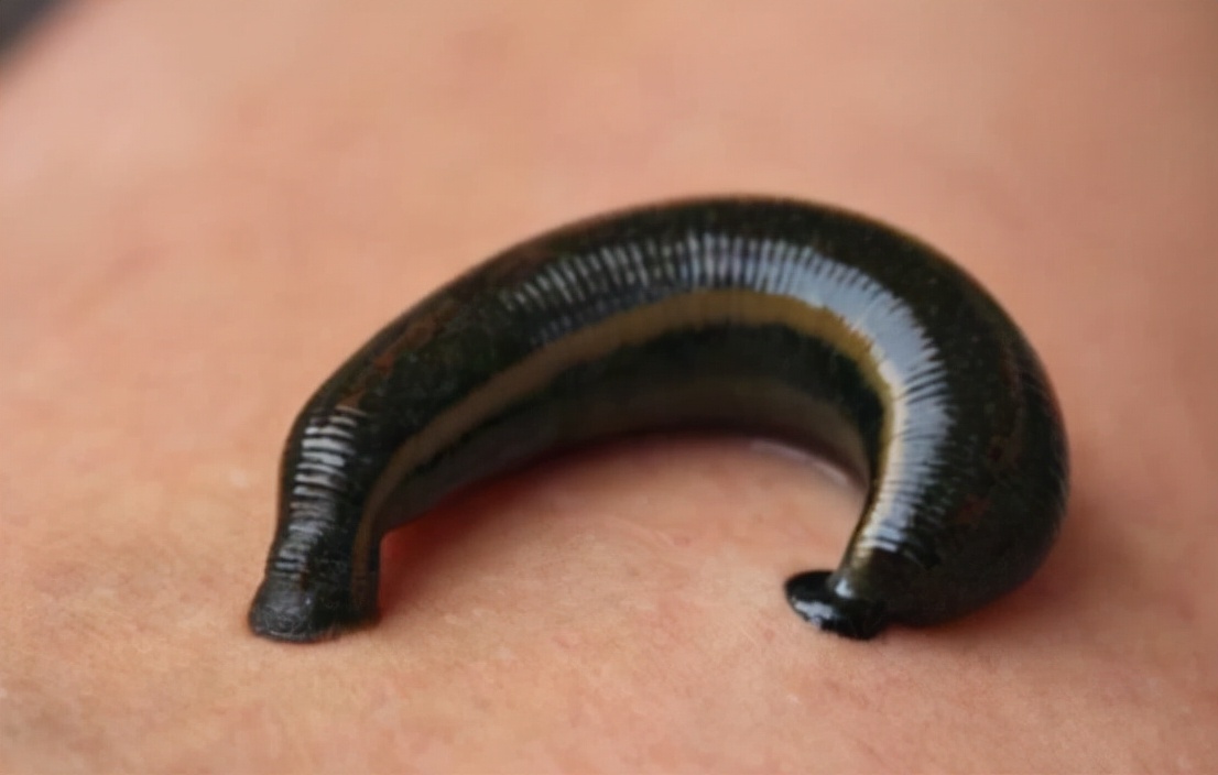 如果蚂蟥进入呼吸道能存活多久,蚂蟥寄生到体内多久能长大