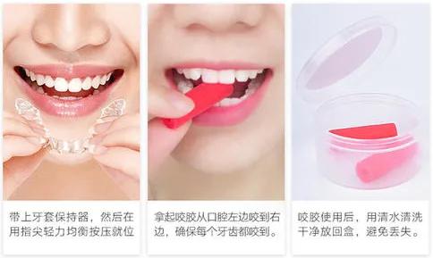 正畸变美的案例,正畸改善龅牙