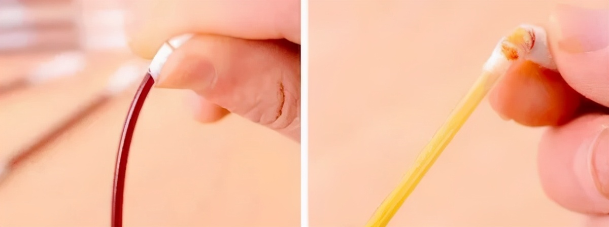 100个有趣的小发明,有哪些有趣小发明