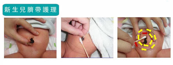 宝宝护理的常见问题怎么处理,百天婴儿照顾