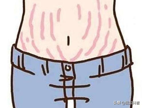 坐月子期间可能出现的问题,坐月子期间出现这些症状正常吗