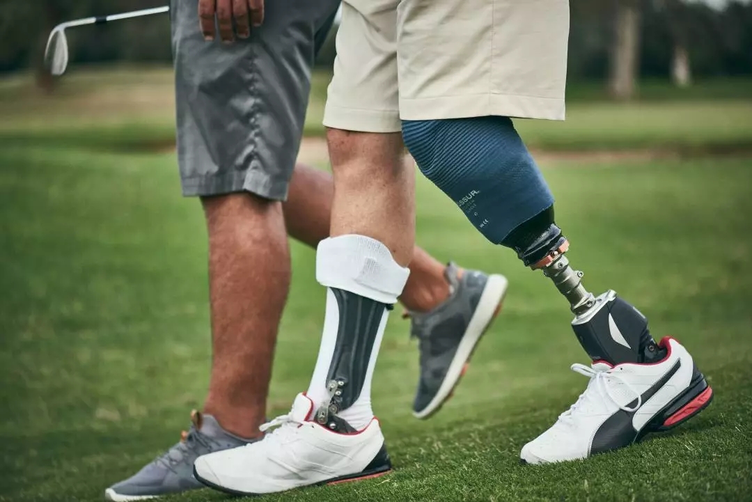 截肢后戴假肢老是疼怎么处理,截肢病人注意事项