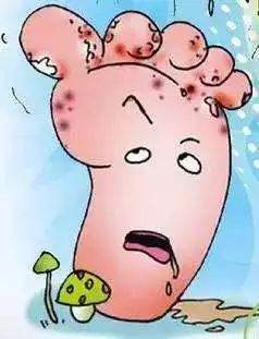 引起脚跟疼痛的原因有哪些,引起脚痒的四大诱因你都知道吗