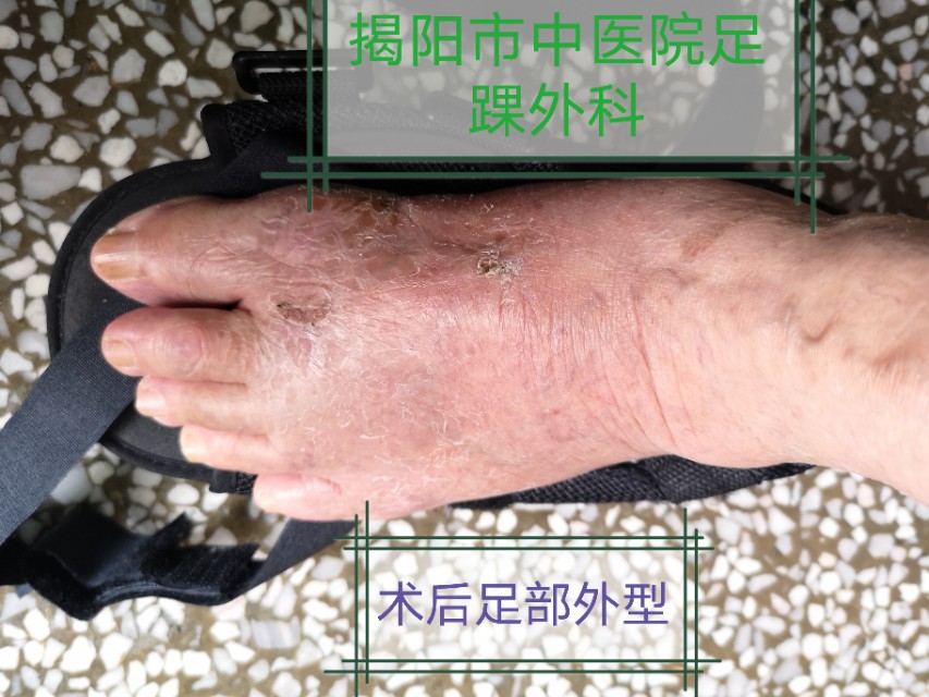 关注足部的健康,关注足部健康