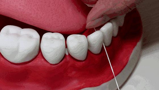 牙齿松动不是小事千万别忽视,牙齿松动不都是肾的事