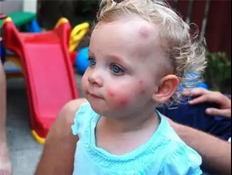 灭蚊神器家用灭蚊灯静音无辐射,灭蚊灯驱蚊子家用室内