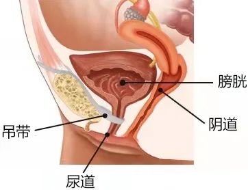 写了六年科普文，竟挡不住弟媳加入微商卖缩阴