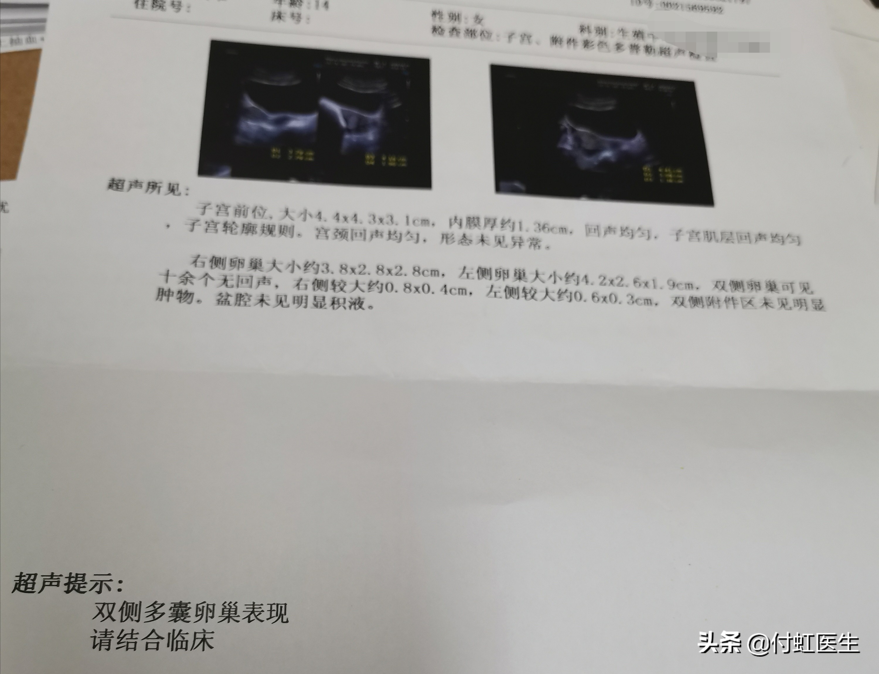 14岁年龄月经不调怎么办,14岁月经不调三年