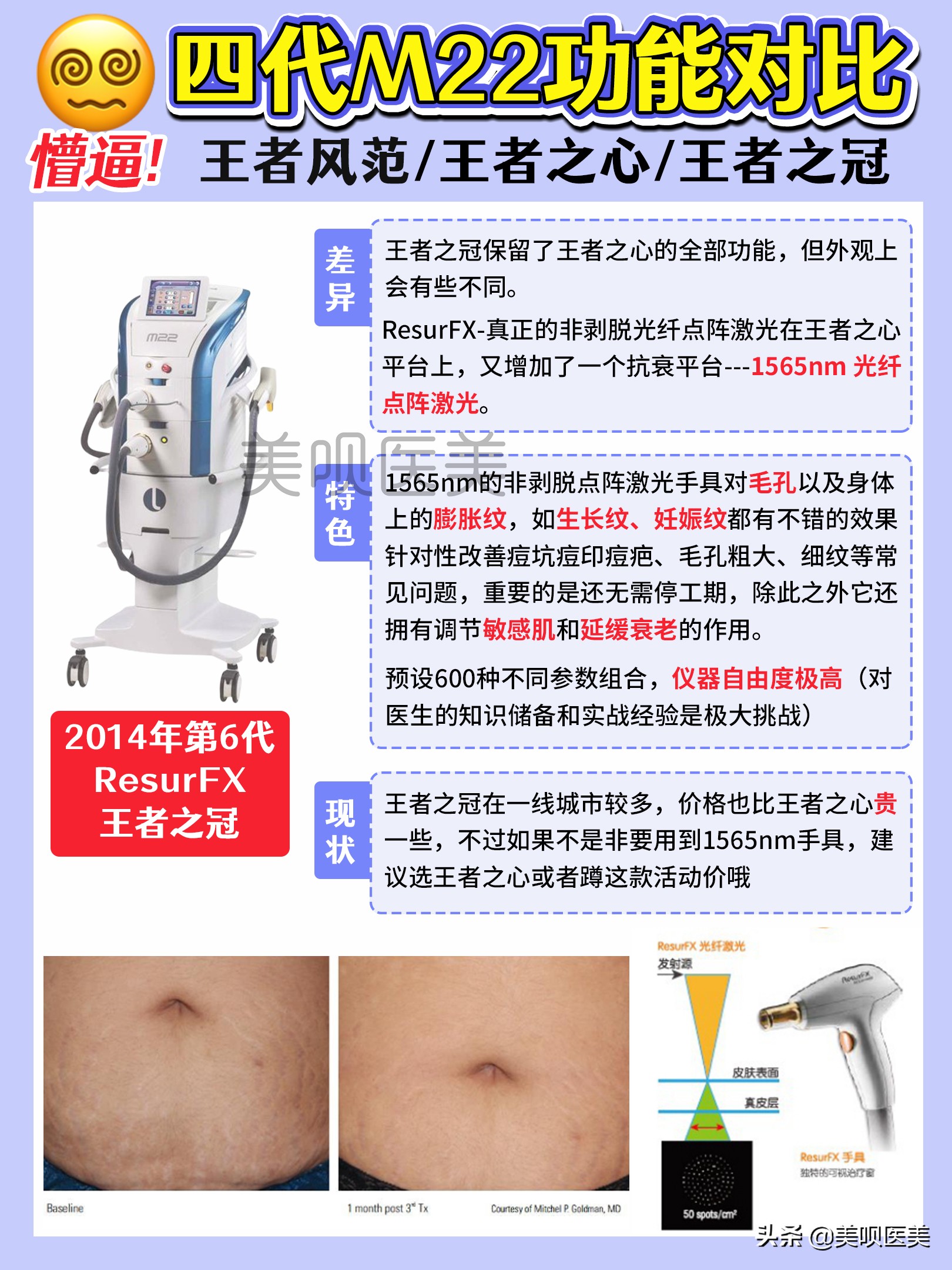 m22光子嫩肤祛红印效果图,m22光子嫩肤全模式和单模式区别