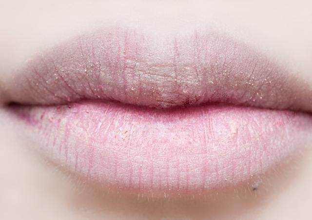 这个不到20块钱的润唇膏,居然可以治疗唇炎,尤其推荐干燥季节用