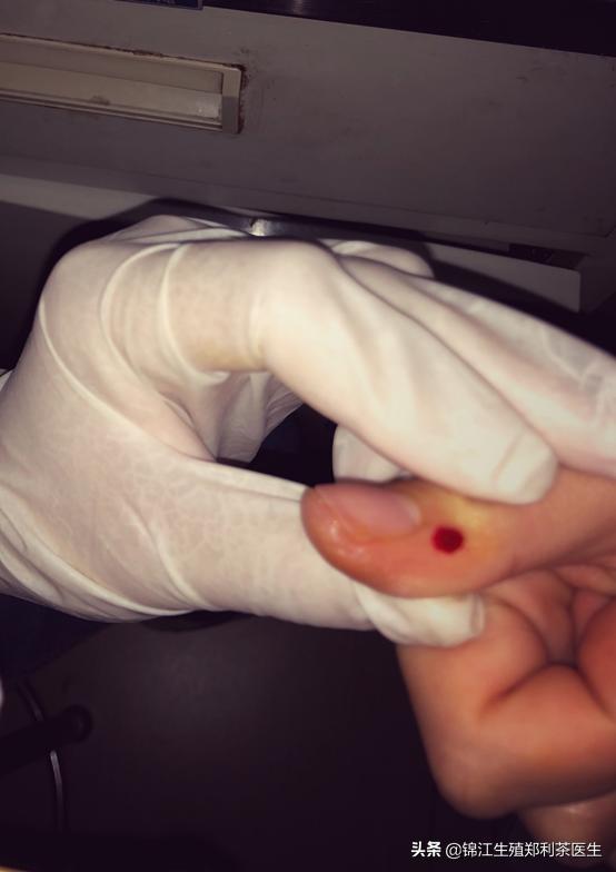 试管移植后上火吃什么降火最快,试管移植后上火怎么治