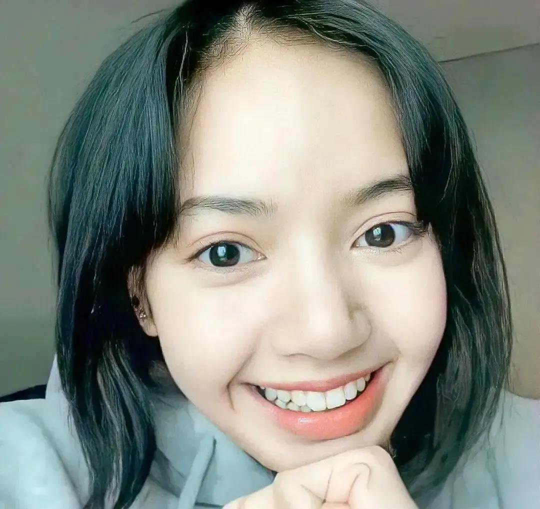 lisa的发际线变高了,lisa发际线为什么看着不高