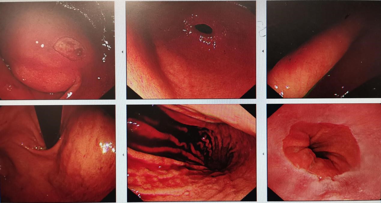 狡猾的它不是癌，却胜似癌
