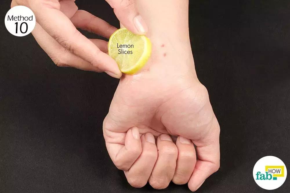 蚊子咬了用什么药膏止痒最快,蚊子咬了用什么药膏止痒快