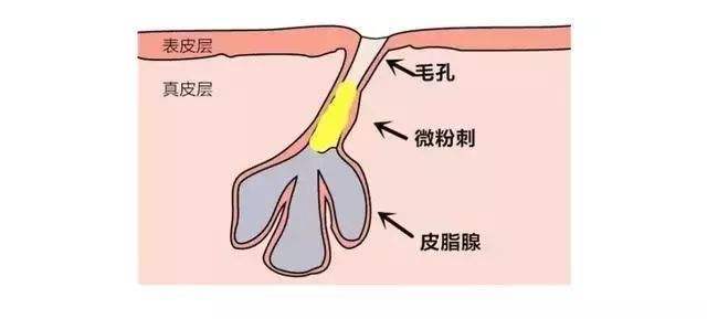 眼睛周围长特别痒小疙瘩怎么回事,女性眼睛周围长疙瘩是什么原因
