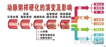 腰围是骨骼决定的,腰围的决定因素