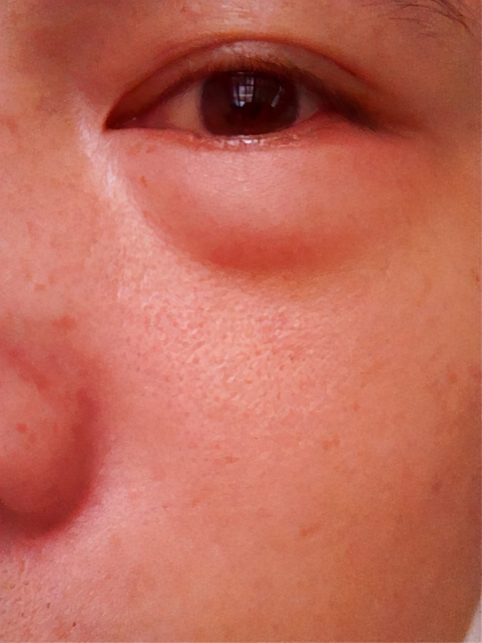 脚丫子都肿是什么原因造成的,脚丫子痛不肿关节痛怎么回事