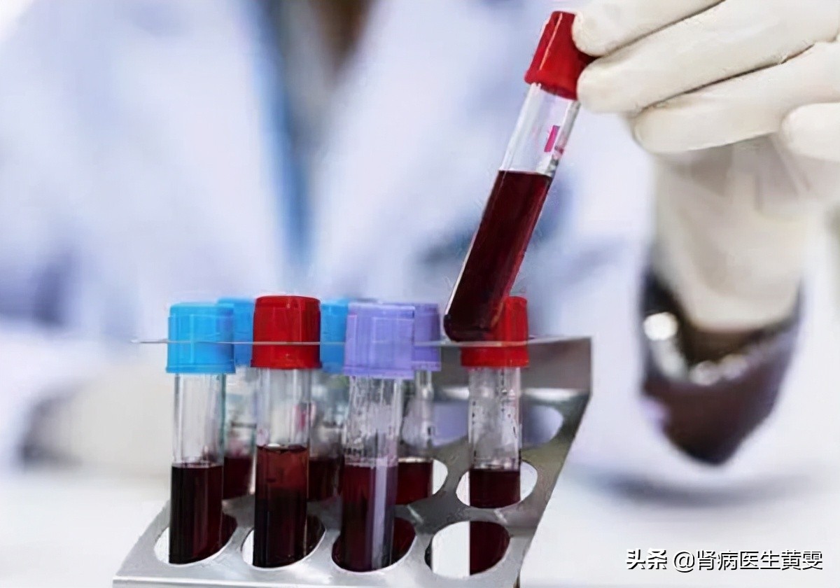 肾肌酐高到多少需透析,肾透析降肌酐的最好方法