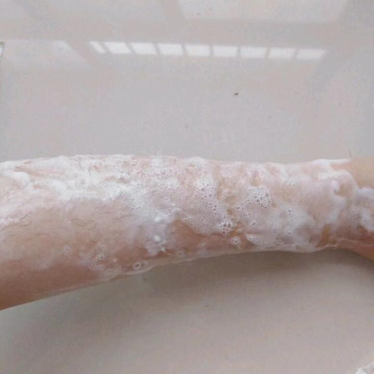 夏天冰点无痛脱毛好处,夏日无痛脱毛