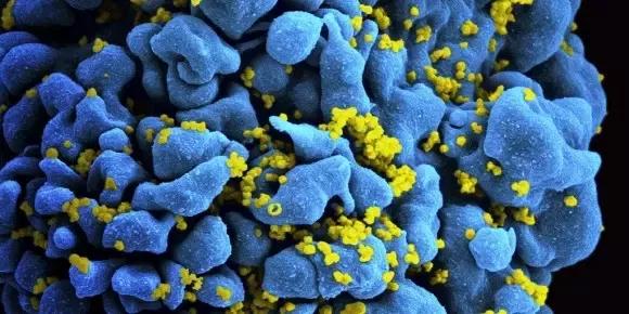 葛兰素史克称一长效药可预防艾滋病！两月注射一次，收效接近疫苗