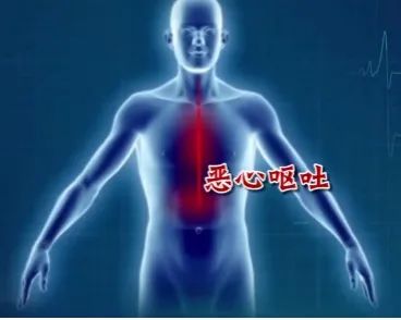 没有征兆而突发心梗有多可怕,哪些地方疼会是心梗的前兆