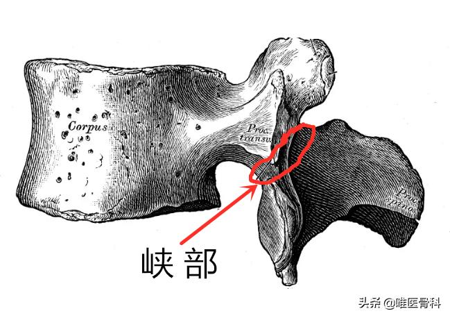 腰椎滑脱的十大危害,腰椎滑脱如何做出准确诊断