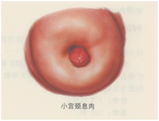生理活动后第二天少量出血,内裤有少量血是怎么回事