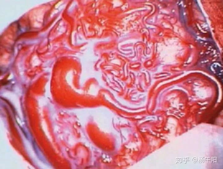 为什么医院叫神经外科,为什么神经外科医生都建议做手术