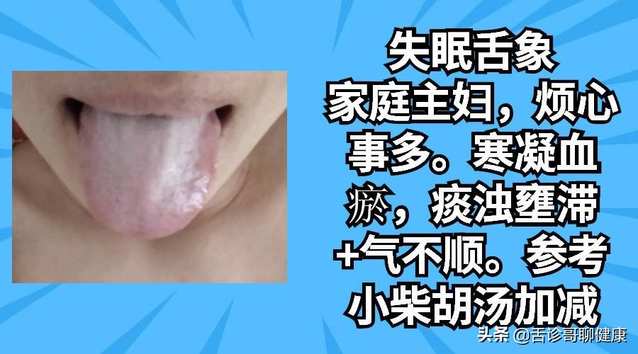 舌诊哥舌象分析视频,舌诊歌健康问答全集